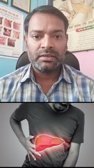लीवर की बीमारियों का इलाज किस डॉक्टर से कराएं ।