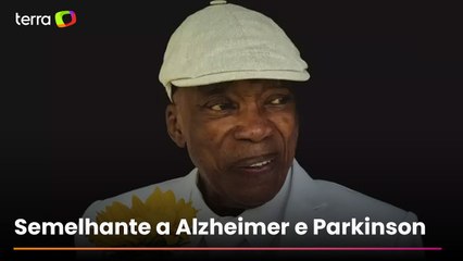 Milton Nascimento é diagnosticado com demência por corpos de Lewy; entenda doença