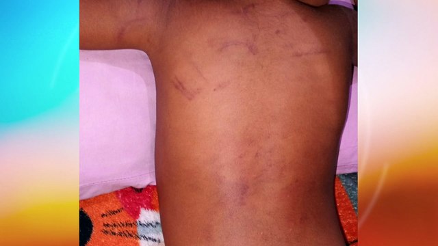 Tortura Infantil: Revelações Sobre o Abuso de uma Menina de 4 anos em Jaboatão dos Guararapes