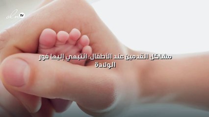 مشاكل القدمين عند الأطفال: انتبهي إليها فور الولادة