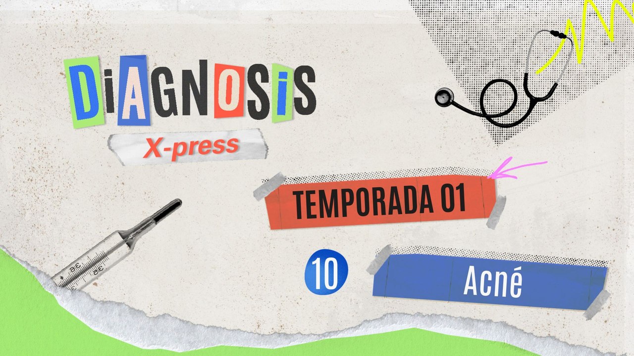 10 ACNÉ