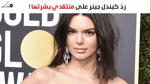 كيف ردّت كيندل جينر على منتقدي بشرتها السيئة؟