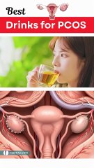 3 Simple Drinks to HELP Manage PCOS Symptoms Daily