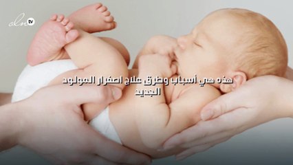 هذه هي أسباب وطرق علاج اصفرار المولود الجديد