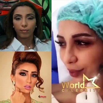 تسريب فيديو ل دنيا بطمة تخضع لعملية تجميل بكامل وجهها