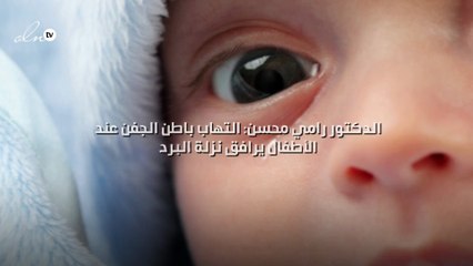 الدكتور رامي محسن: التهاب باطن الجفن عند الأطفال يرافق نزلة البرد...