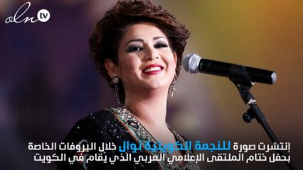 أحدث إطلالة لنوال الكويتية بدون مكياج... إحكمي بنفسكِ!