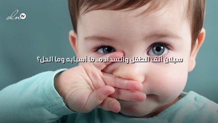 سيلان أنف الطفل وانسداده.. ما أسبابه وما الحل؟