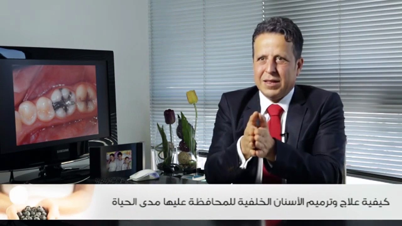 كيفية علاج وترميم الأسنان الخلفية للمحافظة عليها مدى الحياة