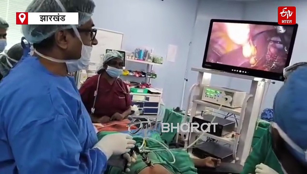 रांची सदर अस्पताल के नाम एक और उपलब्धि, लेफ्ट साइडेड गॉल ब्लैडर स्टोन की हुई सफल सर्जरी