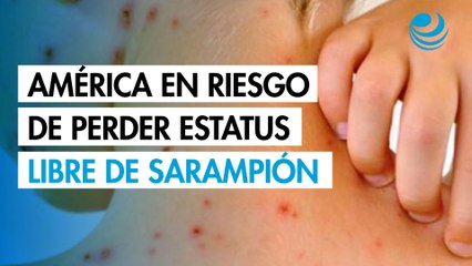 América podría perder su estatus como zona libre de sarampión por brotes en Canadá, México y EU
