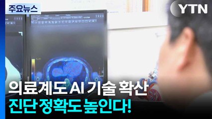 의료계도 AI 기술 확산...진단 정확도 높인다! / YTN