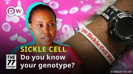 Here's how an Ugandan teacher beat sickle cell disease