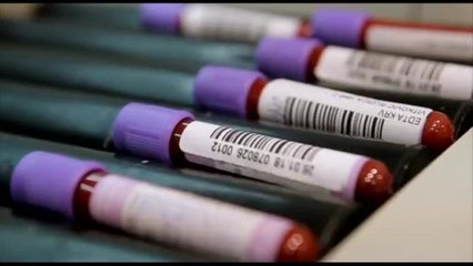 Ematologia, l'innovazione terapeutica e gli impatti sull'organizzazione