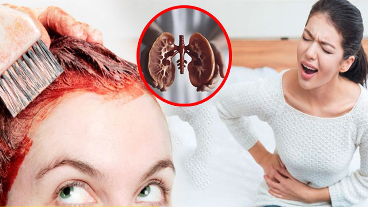 Hair Dye Side Effects: 20 Year Old Girl का Hair Color से Kidney Damage, क्यों खतरनाक है |Cancer Risk