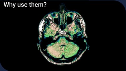 The Ultimate Guide to Mnemonic Devices