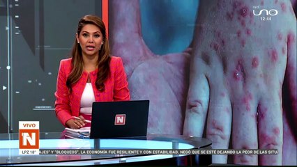 CARNET DE VACUNACIÓN OBLIGATORIO, SE DESCARGARÁ DEL PORTAL WEB