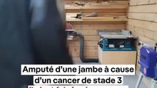 😨 Amputé d’une jambe, il crée sa prothèse ⁉️