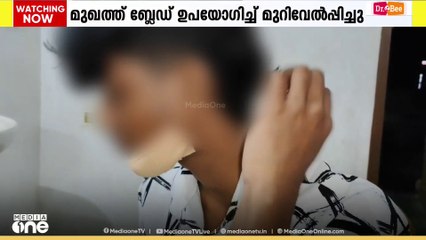 മുഖത്ത് ബ്ലേഡ് ഉപയോ​ഗിച്ച് മുറിവേൽപിച്ചു; വിദ്യാർഥിക്ക് ​ഗുരുതര പരിക്ക്
