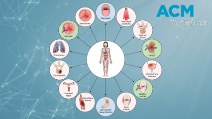 Mystery strep infection on the rise among Aussies, experts warn