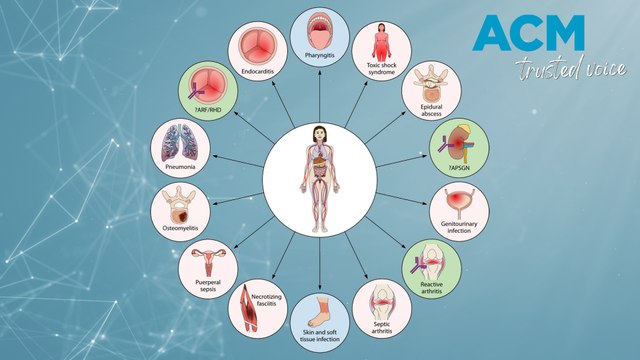 Mystery strep infection on the rise among Aussies, experts warn