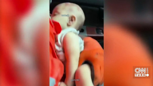 Gazze'de minik canı kurtarmak için zamanla yarıştı