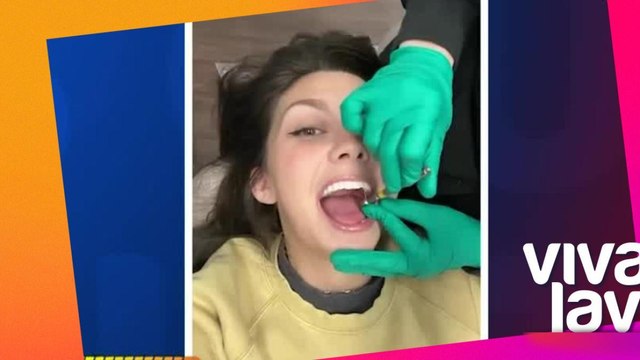 Joven se quita todos los dientes para ponerse dentadura falsa