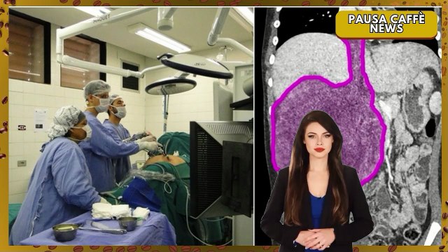 Ultrasuoni contro il tumore, la scoperta dell’istotripsia spiegata passo dopo passo