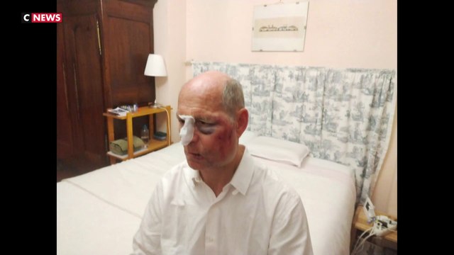 Nantes : un cycliste agressé par deux individus, les suspects relâchés sous contrôle judiciaire