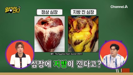 살 빼면 눈 건강도 같이 좋아진다! 갱년기 살과 함께 생긴 지방간 요요