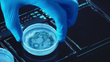 Malattie rare, la diagnosi adesso si fa con la tomografia olografica