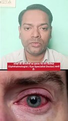 आंखों की बीमारियों का इलाज किस डॉक्टर से कराएं ।