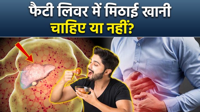 Fatty Liver Me Mithai Khana Chahiye Ya Nahi, क्या फैटी लिवर में मिठाई खा सकते है...|Boldsky