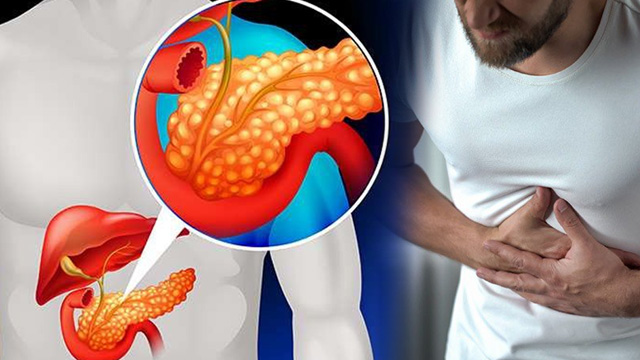 Pancreas Divisum क्या होता है, Causes, Symptoms & Treatment In Hindi...|Boldsky