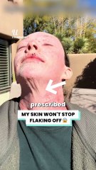 Doctors were wrong, it made my skin worse 😓