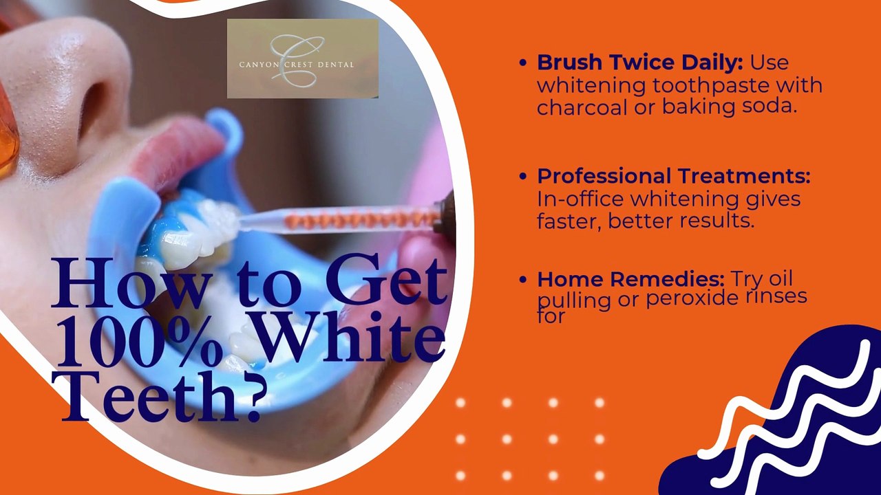 💥The SECRET WHITE TEETH ( Works 100% ) Treatment in Riverside, CA | Teeth Whitening At The Dentist