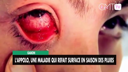 [#Reportage] Gabon : l'appolo, une maladie qui refait surface en saison des pluies