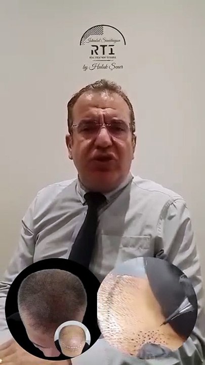 18 SAÇ SİMÜLASYONU KİMLERE YAPILIR? SAÇ SİMÜLASYONU AKADEMİSİ BY HALUK ŞENER