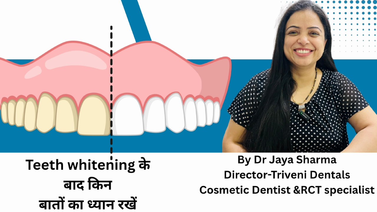 What to avoid after teeth whitening? I In-office Teeth Whitening I Teeth Bleaching | Triveni Dental
