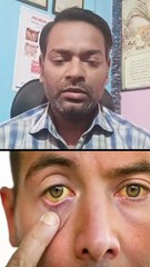 खून को बढ़ाने वाले फल ।