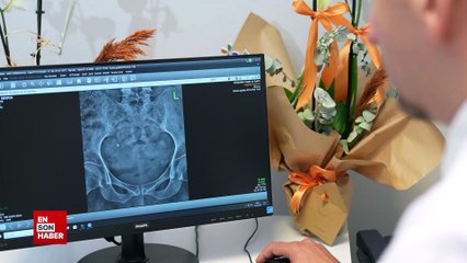 Koronavirüs sonrası kalça kemiğinde erime vakalarında artış