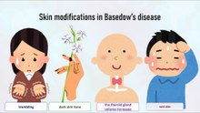Skin modifications in Basedow's disease
