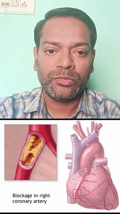 हार्ट के ब्लॉकेज को कम करने वाले प्राकृतिक खाने ।
