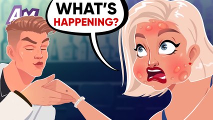 My face swelled up twice its size from my fiancé's kiss