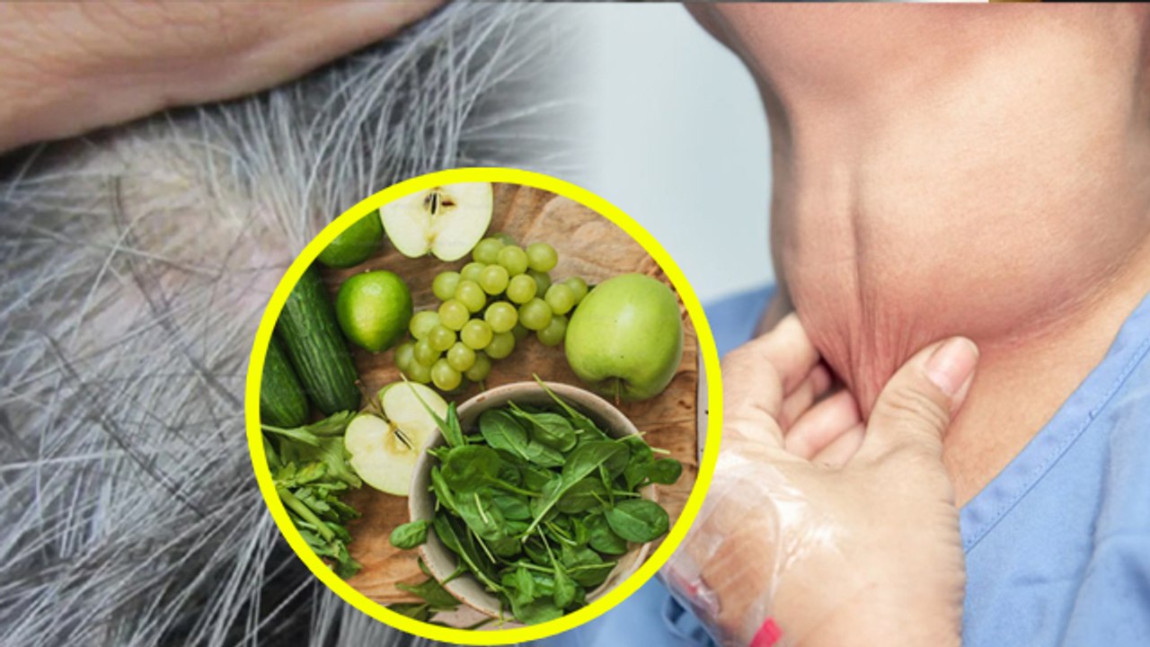 White Hair Causes: उम्र से पहले बाल सफेद होना किस बीमारियों का संकेत,Safed Baal Ka Ilaj | Boldsky