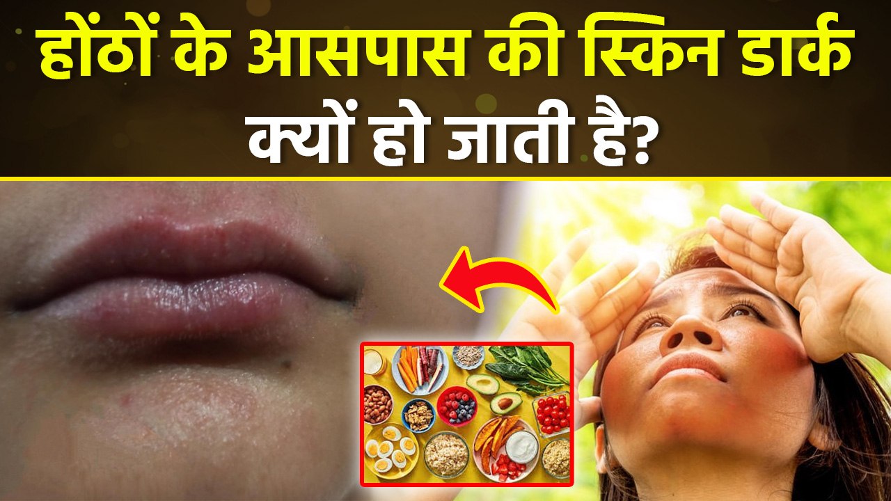 होंठों के आसपास की स्किन डार्क क्यों हो जाती है, कालापन कैसे दूर करें |Upper Lips Darkness Treatment