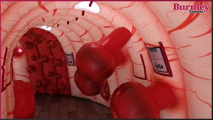 Giant inflatable bowel comes to Burnley to raise awareness of bowel cancer