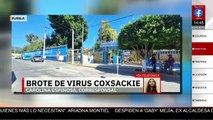 En Puebla, activan alerta sanitaria por un brote del virus Coxsackie