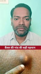 कैंसर की गांठ की सही पहचान ।
