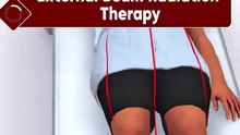 External Beam Radiation Therapy #radiation #therapy